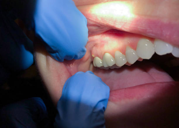 Best Emergency Cosmetic Dentistry in Palmetto, GA